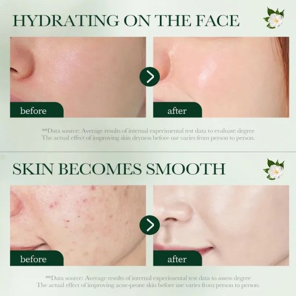 SADOER Tea tree-based face cream for problem skin 50g.